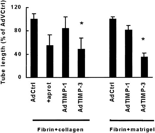 Fig. 4. TIMP-3 impairs capillarylike tubular structure formation. / hMVECs were infected with control virus Ad.PC10 (AdCtrl), a virus containing TIMP-1 (AdTIMP-1) or TIMP-3 (AdTIMP-3) as described and were cultured on top of a 3-dimensional matrix containing fibrin and 10% collagen in M199 supplemented with 10% HS and 10% NBCS and stimulated with 50 ng/mL VEGF165and 10 ng/mL TNF-α. After 4 days of culturing, total tube length was measured as described and expressed as percentage of tube length formed by VEGF165/TNF-α-stimulated hMVECs infected with control virus. The data are expressed as mean ± SD of 6 experiments with duplicate wells for fibrin-collagen matrices. *P < .05 as compared with AdPC10.