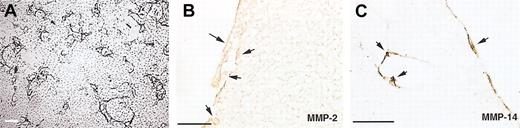 Fig. 6. Localization of MMPs in endothelial cells present in the capillarylike tubular structures in a fibrin-collagen matrix. / hMVECs were cultured on top of a 3-dimensional fibrin matrix containing 10% collagen in M199 with 10% human serum and 10% NBCS and were stimulated with 50 ng/mL VEGF165 and 10 ng/mL TNF-α. After 4 days of culture, nonphase micrographs were taken (A), the matrices were fixed and embedded as described, and 4-μm cross-sections perpendicular to the matrix surface were cut and stained for MMP-2 (B) and MT1-MMP (MMP-14) (C). Immunohistochemistry was performed as described. Arrows indicate areas of positive staining. Scale bar = 300 μm (A) or 50 μm (B-C).
