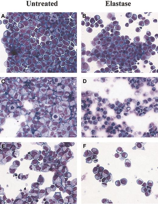Fig. 3. Morphologic changes in culture induced by elastase. / Cytospin preparations of CD34+ cells cultured with 25 ng/mL G-CSF, GM-CSF, and SCF and with or without 1 μg/mL elastase on days 3, 6, and 8. (A-B) Day 3: no differences between control and elastase-treated cells. (C-D) Day 6: widespread apoptosis in differentiating elastase-treated CD34+ cells. (E-F) Day 8: mature neutrophils observed almost exclusively in control cultures. Original magnification, × 400.