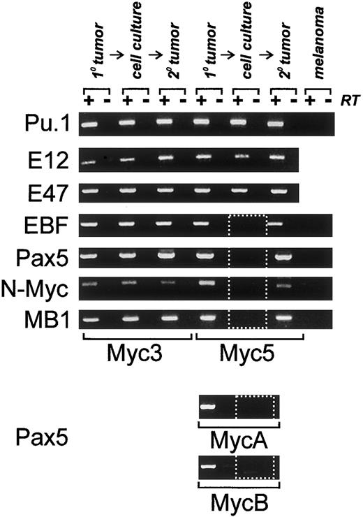 Fig. 3. Expression of B-specific transcription factors and their targets is altered in some Myc-tumor cell lines. / All panels depict RT-PCR analyses of mRNAs encoding proteins specified on the left. Primary (1°) tumors, cultured cells, or secondary tumors derived from cultured cells (2°) were used as sources of RNA. +/−RT refers to reactions carried out in the presence and absence of reverse transcriptase. B16.F10 murine melanoma cells were used as a negative control. Dotted box indicates lack of expression of EBF,Pax5, and Pax5 target genes. Expression of the Pax5 protein in primary tumors was also confirmed using Western blotting (data not shown).