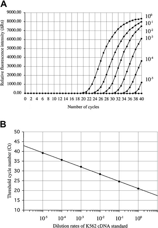 Fig. 1. WT1 amplification plot and standard curve. / (A) Amplification plot of a 10-fold serial dilution of the standard K562 cDNA (ranging from 10−5 to 100) and (B) standard curve of K562 cDNA dilution for real-time RT-PCR. The amplification plot shows the increase of reporter fluorescence (ΔRn) during amplification. The Ct value decrease was proportional to the increase of the target molecules. The standard curve shows the linear correlation between the Ct value and the logarithm of the initial concentration of the standard K562 cDNA and can then be used to calculate the relative WT1 gene expression levels in unknown patient samples.