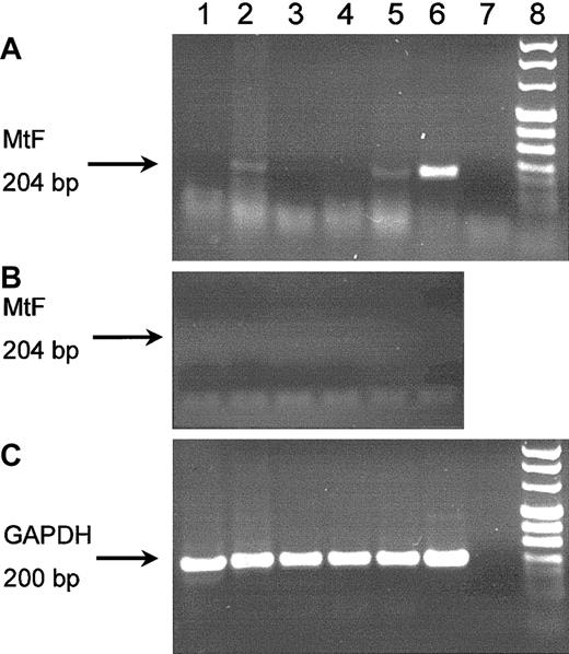 Fig. 3. RT-PCR evaluation of MtF mRNA expression in peripheral blood reticulocytes. / DNAase-treated mRNA preparations were reverse transcribed and PCR amplified, and amplification products were then evaluated by electrophoresis. Panel A shows an RT-PCR study using MtF specific-oligonucleotides (45 cycles); in lanes 2, 5, and 6, a fragment of 204 bp (indicated by the arrow) is clearly observable. The fragment was digested by BamHI to confirm the identity of the product as MtF. Panel B shows the negative findings of the control study without RT treatment. The arrow indicates the expected position of the 204-bp amplicon. Panel C shows an RT-PCR study using oligonucleotides specific for glyceraldehyde phosphate dehydrogenase (GAPDH); in all lanes but one (the negative control), a band of 200 bp (indicated by the arrow) is visible. Lanes 1 and 3: heterozygous women with the ALAS2 Cys395Tyr mutation.12 Lane 2: hemizygous man with the ALAS2 Cys395Tyr mutation and clinically manifest XLSA.12 Lanes 4 and 5: hemizygous men (brothers) with the ALAS2 Arg560His mutation and absent phenotypic expression of the disease (lane 4) or clinically manifest XLSA (lane 5).14 Lane 6: HeLa cells expressing the MtF gene after transfection. Lane 7: water. Lane 8: molecular markers.
