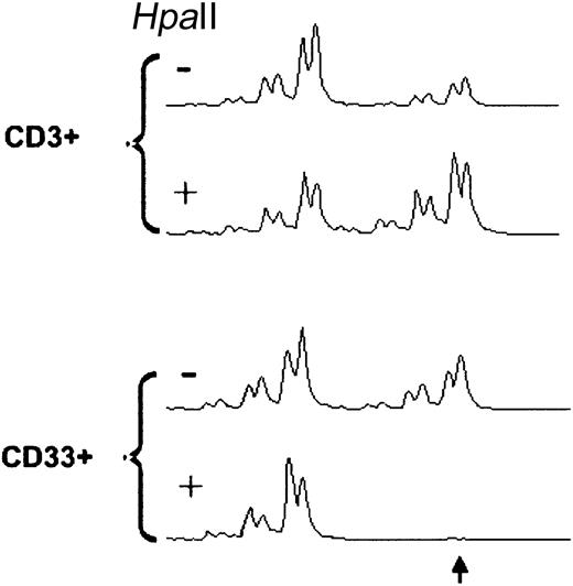 Fig. 3. HUMARA-PCR in CD33+ from patient no. 33 at 6 months after induction of MCR by imatinib. / HpaII indicates HpaII digestion of DNA. FISH of CD33+ WBCs failed but 77% of total WBCs carried t(20;21), whereas BCR-ABL was not detected. Note that the larger allele (arrow) is lacking from the HpaII-digested CD33+ cells but not from the CD3+ cells, consistent with a monoclonal CD33+ population.