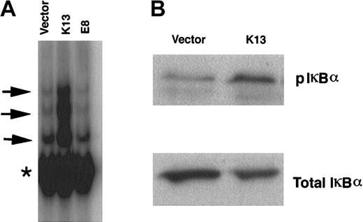 Fig. 4. HHV8 vFLIP activates the NF-κB pathway in TF-1 cells. / (A) Electrophoretic mobility shift assay demonstrating persistent NF-κB activation in TF-1 cells expressing vFLIP K13. The positions of the induced NF-κB complexes are marked with arrows while an asterisk (*) marks the position of a constitutive NF-κB complex. (B) Western blot analysis demonstrating increased phosphorylation (top panel) and decrease in the total IκBα protein (bottom panel) in TF-1 cells expressing vFLIP K13.