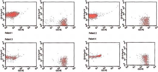 Fig. 1. Flow cytometric confirmation of sample purity of B (CD19) and T (CD3) lymphocyte fractions that are sorted by antibody-linked immunomagnetic beads from 4 patients with myelofibrosis with myeloid metaplasia.