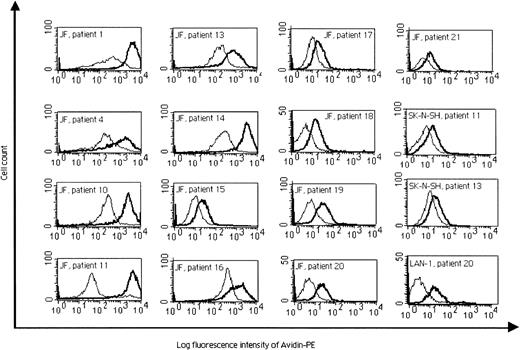 Fig. 2. Flow cytometric analysis of IgG production before treatment (thin profile) and 5 to 8 days after the fourth injection (bold profile), presented as the log fluorescence intensity of PE-conjugated secondary avidin-conjugated antibody. / Reactivity of the sera from patients 1, 4, 10, 11, and 13 to 21 against the JF cell line, from patients 11 and 13 against a GD2low cell line, SK-N-SH, and from patient 20 against a GD2high cell line, LAN-1, are presented.