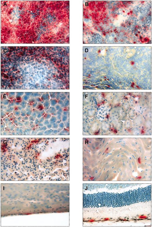 Fig. 3. Histochemical staining for GUSB revealed positive cells in many tissues throughout NOD/SCID/MPSVII mice that received transplants of human CD34+ cells. / Tissues from a single NOD/SCID/MPSVII mouse 12 weeks following the transplantation of human CD34+ cells from cord blood are shown stained for GUSB activity (red color) and counterstained with methyl green (blue-green color). The bone marrow (A) and spleen (B) contained high levels of positive cells that correlated with a flow cytometric measurement of human CD45 expression (87% human CD45+ in the bone marrow and 61% human CD45+in the spleen). Groups of GUSB+ cells were visible throughout the lymph node (C), whereas scattered GUSB+cells were evident in the thymus (D). The liver (E) was uniformly infiltrated with GUSB+ cells, and the kidney (F) and lung (G) contained a less dense pattern of positive cells. GUSB staining was also seen in scattered cells in the heart (H), at regular intervals in the meninges (I), and in association with the pigment epithelial layer of the retina (J). Original magnification, × 250.