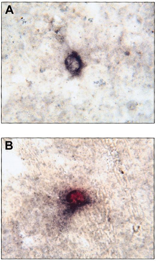 Fig. 6. Immunohistochemical staining for human CD45 colocalized with GUSB histochemical staining in the liver of a NOD/SCID/MPSVII mouse following transplantation of human CD34+ cells. / (A) A cell in the liver of a NOD/SCID/MPSVII mouse 12 weeks after the transplantation of human cord blood CD34+ cells shows black membrane staining following immunohistochemistry for human CD45. (B) After staining for both human CD45 and GUSB activity, a cell in the same NOD/SCID/MPSVII liver as in (A) shows both black membrane signal for human CD45 and red cytoplasmic signal for GUSB activity. GUSB enzyme activity was seen only in the presence of black membrane staining for human CD45. In addition, all human CD45+ cells exhibited GUSB staining. Original magnification, × 833.