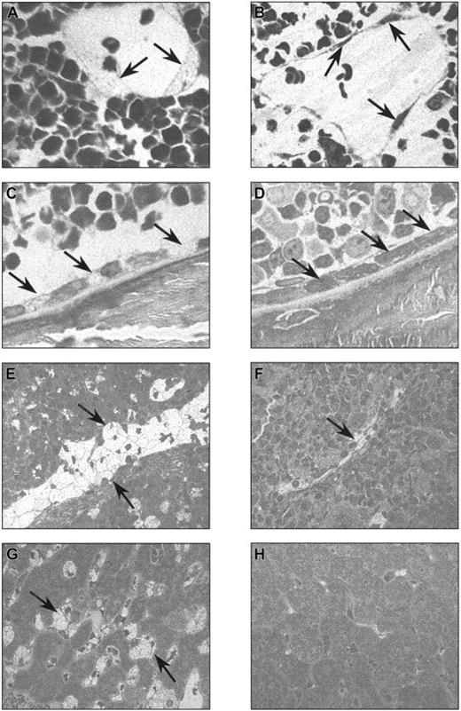 Fig. 7. NOD/SCID/MPSVII mice that received transplants of human CD34+ cells showed correction of tissue pathology in some engrafted tissues. / The tissues of NOD/SCID/MPSVII mice that were either untreated or received transplants of human CD34+ cells were stained with toluidine blue. Lysosomes distended with storage material appear as clear, foamy areas by this method. In the bone marrow of NOD/SCID/MPSVII mice that did not receive transplants, lysosomal storage material (arrows) filled the sinus lining cells (A) and osteoblasts (C). The spleen (E) and liver (G) of untreated NOD/SCID/MPSVII mice also contained large amounts of storage material (arrows). In NOD/SCID/MPSVII mice that received human CD34+cells, the bone marrow sinus lining cells (B) and osteoblasts (D) were essentially free of lysosomal distention (arrows). The spleen (F) of such treated mice typically showed marked correction with only residual levels of storage material present (arrow). The liver (H) of transplanted NOD/SCID/MPSVII mice showed essentially complete removal of lysosomal storage material. Original magnifications: × 833 (A-D); × 416 (E-H).