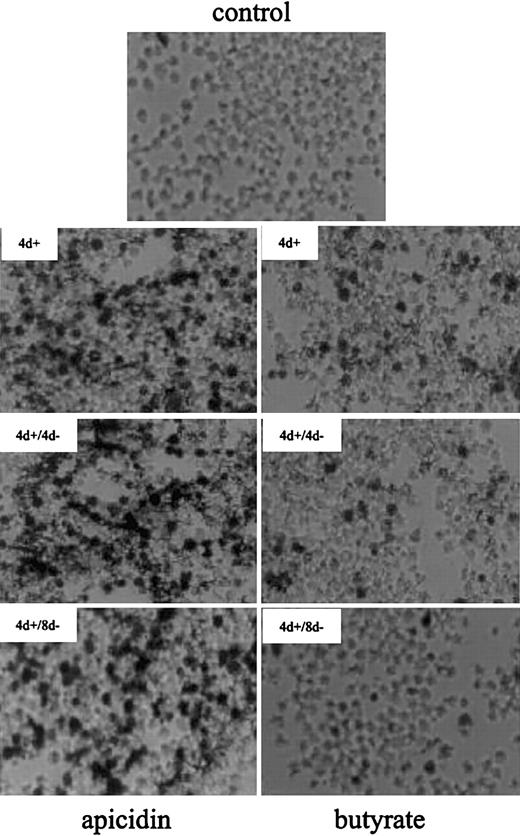 Fig. 2. Benzidine staining of K562 cells treated with butyrate and apicidin. / Cells were cultured in the absence (control) or presence of 0.5 μM apicidin (left panels) or 0.6 mM butyrate (right panels) for 4 days (4 d+). Thereafter, the compounds were removed from medium and cultured for another 4 days (4 d+/4 d−) or 8 days (4 d+/8 d−), respectively. After harvesting, intracellular hemoglobin was detected by benzidine staining, and cell smears were subjected to microscopy using × 400 magnification.