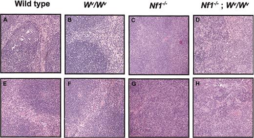 Fig. 1. Effects of Wv andNf1 genotypes on splenic architecture in primary and secondary recipients. / (A-D) Low-power view (original magnification × 10) of spleen sections from primary recipients of transplanted fetal liver cells from the 4 F2 experimental groups outlined in “Study design.” Recipients of transplanted Nf1+/+;Wv+/+and Nf1+/+;Wv/Wv fetal liver cells show a normal distribution of red pulp and white pulp (A-B). In contrast, recipients of transplantedNf1−/−;Wv/Wv orNf1−/−;Wv+/+ fetal liver cells showed expansion of the red pulp with loss of normal splenic architecture (C-D). (E-H ) A representative low-power view (original magnification × 10) of spleen sections from secondary recipients of transplanted low-density mononuclear cells harvested from the bone marrow of primary recipients of transplanted fetal liver cells from the 4 F2 experimental groups. Secondary recipients of transplantedNf1+/+;Wv+/+ andNf1+/+;Wv/Wv LDMNCs show a normal distribution of red pulp and white pulp (n = 7 for each genotype) (E-F). In contrast, secondary recipients of transplantedNf1−/−;Wv/Wv orNf1−/−;Wv+/+ LDMNCs showed expansion of the red pulp with loss of normal splenic architecture (n = 7 for each genotype) (G-H).