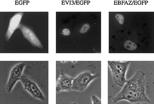 Fig. 6. Nuclear localization of EVI3 and EBFAZ fusion proteins. / Upper panel: UV microscopy of HeLa cells transfected with constructs encoding EGFP, EVI3/EGFP, or EBFAZ/EGFP. Lower panel: the same cells seen in phase-contrast microscopy. Original magnification is × 40.