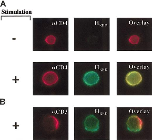 Fig. 2. Distinct localizations of the TCR and HTLV Env receptor in activated CD4+ lymphocytes. / (A) Unstimulated or αCD3/αCD28-stimulated CD4+lymphocytes were incubated with an αCD4 mAb, detected with a goat antimouse IgG-Cy3, and the HTLV Env SU RBD fused to EGFP (HRBD-EGFP). Cells were examined by confocal immunofluorescence microscopy. (B) Capping was induced in prestimulated CD4+ lymphocytes using an αCD3 mAb. After a 30-minute induction at room temperature, cells were fixed and incubated with a goat αmouse IgG-Cy3 and HRBD-EGFP to visualize the localization of CD3 and the HTLV receptor, respectively. Original magnification, × 100.