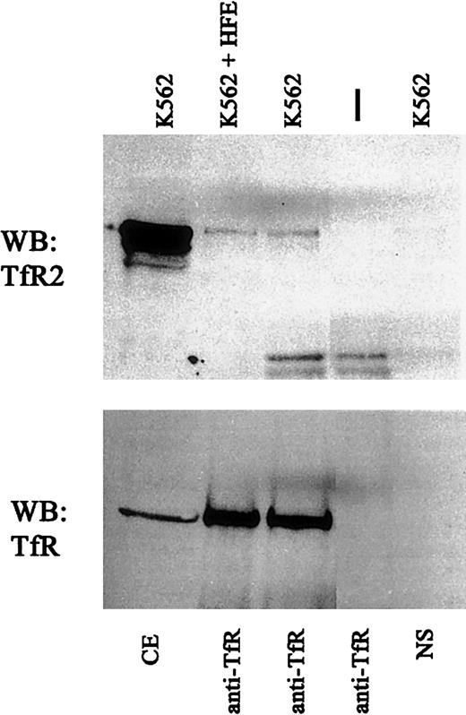 Fig. 5. HFE does not alter TfR-TfR2 interaction. / Cell extracts from K562 cells were incubated with 1 μM purified recombinant HFE for 60 minutes at 4°C (K562 + HFE) and immunoprecipitated using sheep anti-TfR serum andS aureus (IP:TfR). Immunoprecipitated proteins were subjected to SDS-PAGE on an 8% gel, transferred to nitrocellulose, and immunodetected for TfR2 (upper panel) (WB:TfR2) and TfR (lower panel) (WB:TfR). NS indicates background control using K562 cell extracts and S aureus without antibody; vertical dash, no cell extract with anti-TfR and S aureusonly; and CE, cell extract.
