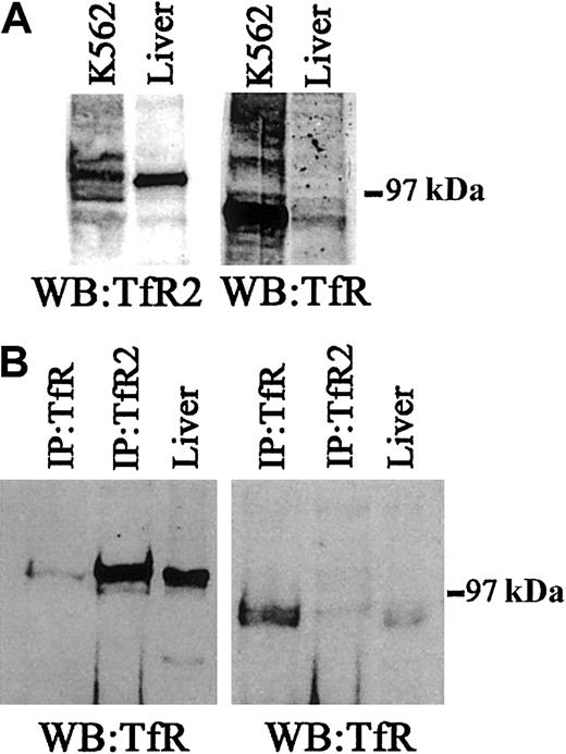Fig. 7. TfR and TfR2 protein expression in human liver. / (A) To determine the relative levels of TfR and TfR2 protein in human liver tissue and K562 cells, 50 μg of cell extracts were Western blotted for either TfR (WB:TfR) or TfR2 (WB:TfR2). The panel on the left was developed using a mouse monoclonal antibody to human TfR2 (1:10 000), while the panel on the right was developed using a mouse monoclonal antibody to TfR (1:10 000). (B) To determine whether TfR and TfR2 interact in human liver, a series of immunoprecipitations for either TfR or TfR2, followed by immunoblotting for TfR or TfR2, was performed. Human liver extract (60 μg) was immunoprecipitated with either a sheep polyclonal antibody to TfR (1:100) and 30 μL of S aureus(IP:TfR) or with a mouse monoclonal antibody to TfR2 (1:120) and 30 μL of protein G–Sepharose (IP:TfR2), or the extract was loaded onto the gel (liver). Proteins were separated on an 8% acrylamide gel under denaturing and reducing conditions, transferred to nitrocellulose, and immunoblotted for either TfR (right panel) or TfR2 (left panel).