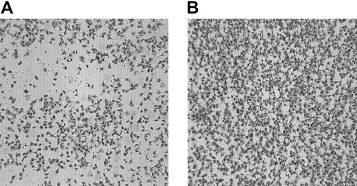 Fig. 1. The effect of coagulation factors VIIa, X, and II on adhesion of platelets from patients with type 1 GT to the subendothelial matrix of PMA-stimulated endothelial cells under flow conditions. / Washed platelets and red cells (200 000 platelets/μL; hematocrit 40%) were perfused over PMA-ECM for 5 minutes at 1600 s−1in absence (A) or presence (B) of a thrombin-generating system (1.2 μg/mL rFVIIa, 10 μg factor X, 20 ng/mL prothrombin, 3 mM CaCl2). Shown is a typical example from one patient with GT. Original magnification × 400 for panels A-B.