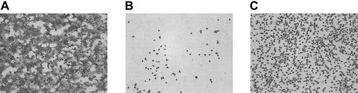 Fig. 2. Development of a model system for adhesion of thrombasthenic platelets to subendothelial structures under flow conditions and the effect of the thrombin-generating system. / Washed normal platelets and red cells (200 000 platelets/μL; hematocrit 40%) were perfused over PMA-ECM for 5 minutes at 1600 s−1 in the absence (A) or presence (B-C) of an RGD-containing peptide (rRGDW; 200 μM). Panel C shows the effect of the thrombin-generating system (1.2 μg/mL rFVIIa, 10 μg factor X, 20 ng/mL prothrombin, 3 mM CaCl2) on adhesion of RGD-inhibited platelets. Original magnification × 400 for panels A-C.