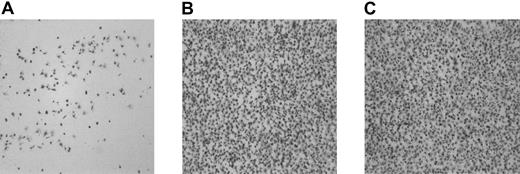 Fig. 3. Adhesion of αIIbβ3-inhibited platelets to collagen type III under flow conditions; increased adhesion by the thrombin-generating system is independent of tissue factor. / Washed normal platelets and red cells (200 000 platelets/μL; hematocrit 40%) were perfused over collagen type III for 5 minutes at 1600 s−1 in the presence of an RGD-containing peptide (rRGDW; 200 μM) in the absence (A) or presence (B-C) of the thrombin-generating system (1.2 μg/mL rFVIIa, 10 μg factor X, 20 ng/mL prothrombin, 3 mM CaCl2). In panel C both the surface and the platelet suspension were preincubated with inhibitory tissue factor IgG. Original magnification × 400 for panels A-C.