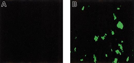 Fig. 4. Binding of rFVIIa to collagen-adhered platelets under flow conditions. / Washed platelets and red cells were perfused over a collagen-coated glass coverslip in the absence (A) or presence (B) of rFVIIa (1.2 μg/mL). After perfusion, coverslips were fixed and bound rFVIIa was visualized by confocal laser scanning fluorescence microscopy using a monoclonal antibody against factor VII followed by a FITC-labeled secondary antibody. Original magnification × 400 for panels A-B.