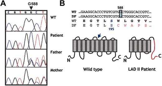 Fig. 1. A single nucleotide deletion in position 588 (G588) in the GDP-fucose transporter gene of the new patient. / (A) Chromatograms show a partial sequence for the GDP-fucose transporter gene from a healthy donor, the LADII patient, and both parents. Note that G588 is absent in the patient, whereas both parents are heterozygotes in this position (overlaid sequence). (B) Partial primary sequence of the gene and the predicted protein region in which the deletion is found. A shift in the open-reading frame alters the protein sequence after Ser195 (arrow), as shown in the schematic representation of the predicted structure of the transporter. This frameshift creates a premature stop codon 34 residues after the mutation (shown in red in the right scheme).