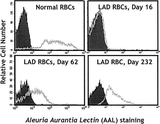 Fig. 8. Neoexpression of fucosylated structures on erythrocytes from the LADII patient following L-fucose treatment. / Erythrocytes from a healthy donor (control) or the LADII patient on days 0, 62, and 232 of treatment were stained with the AAL lectin to detect fucosylated glycoconjugates on the cell surface.