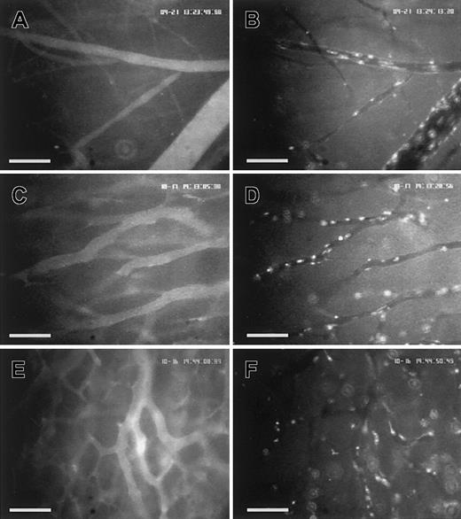 Fig. 3. Visualization of platelets within the microcirculation of postcapillary venules and tumor microvessels in vivo. / The photographs of the intravital fluorescence microscopy demonstrate postcapillary venules of tumor-free striated skin muscle (A-B) and tumor microvessels of LLC-1 (C-D) and BFS-1 (E-F) tumors on day 14 after tumor cell implantation. Imaging of microvasculature and blood plasma flow was achieved after intravenous application of TAMRA-dextran (A,C,E). CFDA-labeled platelets were distributed homogeneously within the microcirculation of the different tissues (B,D,F). Assessment and quantification of platelet-endothelial interaction were performed during playback of the recorded video images. Scale bars represent 100 μm.
