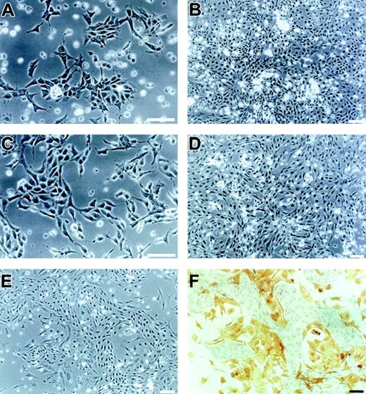 Fig. 2. Differentiated cells in a chemically defined culture of ES cell–derived VEGFR2+ cells. / Sorted VEGFR2+ cells were cultured on type IV collagen–coated dishes under a chemically defined condition without (A-B) or with (C-F) 50 ng/mL VEGF. After 1 day (A,C), 3 days (B,D), or 2 days (E) of culture, differentiated cells were observed by phase-contrast microscopy. (F) Cells shown in panel E were doubly stained with MoAbs for VE-cadherin (purple) and α-smooth muscle actin (brown). Note that spindle-shaped or dendritic-shaped cells were positive for VE-cadherin or α-smooth muscle actin, respectively. Scale bars = 100 μm.