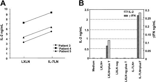 Fig. 5. Cytokine-transduced leukemia cells increase IL-2 and γIFN production in T cells. / Leukemia cells transduced with the IL-7LN or control (LXLN) vector were differentiated in a serum-free cytokine cocktail for one week. Subsequently, 4 to 5 × 104 unsorted or sorted cells were cultured alone or with 105 T cells. After 48 to 72 hours supernatants were harvested and measured for IL-2 and γIFN production using specific ELISA. Panel A shows IL-2 production in 3 different patients using unsorted IL-7LN and LXLN populations. Panel B shows (in 2 different scales) IL-2 and γIFN production by sorted IL-7LN and LXLN-transduced cells from patient no. 2. Controls included in the study are indicated.