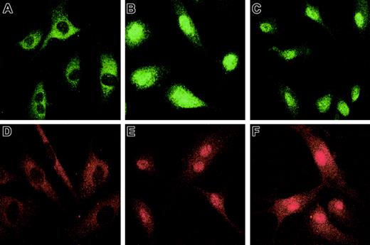 Fig. 3. Hypoxia-induced Smad2 and Smad3 nuclear translocation in HUVECs. / HUVECs were grown to confluence on gelatin-coated chamber slides, serum starved overnight, and exposed for 1 hour to 1% O2 or 20% O2 with or without 100 pM recombinant TGF-β2. After cells were fixed in 4% paraformaldehyde and permeabilized with 0.1% Triton X-100, immunostaining was performed with rabbit anti–Smad2 (10 μg/mL) followed by fluorescein isothiocyanate–conjugated donkey anti–rabbit IgG (3 μg/mL); or rabbit anti–Smad3 (10 μg/mL), followed by rhodamine-conjugated donkey anti–rabbit IgG (3 μg/mL). Immunofluorescence microscopy was performed with a Bio-Rad Radiance 2000 Confocal laser scanning microscope. Immunostaining for Smad2 is shown (A) in normoxic HUVECs, (B) after treatment with 100 pM TGF-β2, and (C) after exposure to hypoxia; immunostaining for Smad3 is shown (D) in normoxic HUVECs, (E) after treatment with 100 pM TGF-β2, and (F) after exposure to hypoxia. Original magnification, × 60.