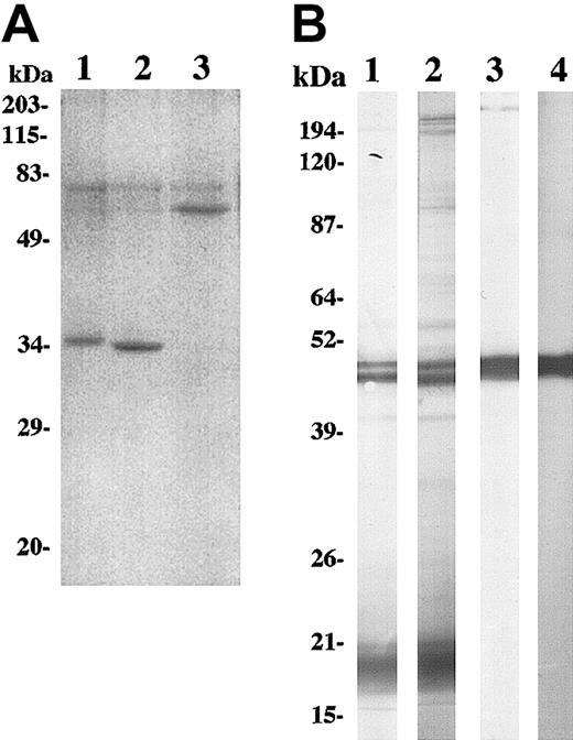 Fig. 2. Expression and binding characteristics of 5.2-OKT3 biscFv. / (A) Samples of scFv were purified from culture supernatants of recombinant baculovirus-infected cells by a Ni-NTA column as described in “Materials and methods.” Purified 5.2 scFv (lane 1), OKT3 scFv (lane 2), and 5.2-OKT3 biscFv (lane 3) were separated by 10% SDS-PAGE and stained with Coomassie Brilliant Blue R-250 (Nippon Bio-Rad Laboratories, Tokyo, Japan). (B) Native PfMSP-1 (lanes 1-2) and rPfMSP-142 (lanes 3-4) were prepared for SDS-PAGE under nonreducing conditions and run on a 5% to 15% gradient gel. Proteins were transferred to Immobilon membranes (Millipore), probed with either 5.2 mAb followed by biotinylated goat anti–mouse IgG antibody (lanes 1,3) or 5.2-OKT3 biscFv followed by biotinylated mouse anti-FLAG M2 mAb (lanes 2,4).