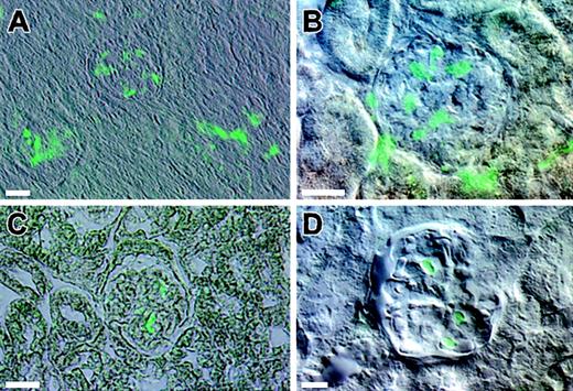 Fig. 2. Composite DIC and epifluorescence images of kidney sections from engrafted animals. / The kidneys from mice with high levels of multilineage engraftment were examined microscopically. (A) A low-magnification image of a vibratome section depicts two glomeruli with associated EGFP+ cells. (B) A higher magnification image of a vibratome section depicts EGFP+ cells within the glomeruli. (C) A representative image is obtained from serial thin sections of an engrafted kidney. (D) A vibratome section of a kidney from a recipient of 100 Lin−, Sca-1+, c-kit+, and CD34− noncultured BM cells also shows similar EGFP+ cells. Bars equal 25 μm.