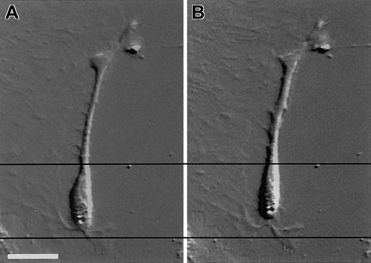 Fig. 3. DIC images of an EGFP+ cell in a culture derived from the glomeruli of an engrafted kidney. / Cultured cells derived from the glomeruli of an engrafted kidney were exposed to 10−6 M angiotensin II at room temperature for 10 minutes. Photos show the cell prior to exposure to angiotensin II (A) and the cell 10 minutes after exposure to angiotensin II (B). Bars equal 25 μm.