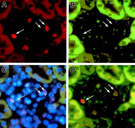 Fig. 4. FISH analysis of Y-chromosome in the glomerular mesangial cells in male-to-male transplantation. / A glomerulus was stained with anti-GFP (red; panel A) and an FITC-labeled Y-chromosome paint probe (green; panel B). Panel C shows triple labeling of the same glomerulus with a combination of anti-GFP, FITC-labeled Y-chromosome paint probe, and bis-benzimide (blue; nuclear label). Panel D is a superimposition of panels A and B. Two of 3 cells (arrows) are donor-derived mesangial cells with only one Y-chromosome. One cell shown has one Y-chromosome and is of recipient origin. Original magnification, × 63.