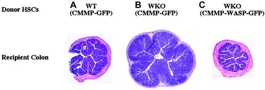 Fig. 4. Retrovirus-mediated gene transfer of WASP in WKO HSCs can ameliorate or prevent colitis in RAG-2 recipient mice. / Shown are representative H and E–stained cross-sections of recipient mouse colons after stem cell transplantation. (A) WT HSCs transduced with CMMP-GFP: no colitis. (B) WKO HSCs transduced with CMMP-GFP: severe colitis; note increased diameter due to epithelial hyperplasia and leukocyte infiltration into the lamina propria. (C) WKO HSCs transduced with CMMP-WASP-IRES-GFP: no colitis. Untreated RAG-KO mice do not develop colitis. Original magnification × 40 for all panels.
