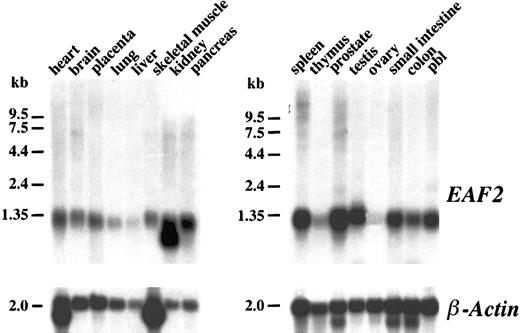 Fig. 3. Northern blot analysis. / Human multiple tissue Northern blots were hybridized with anEAF2 cDNA probe. EAF2 is broadly expressed in multiple tissues except in liver, thymus, and ovary. The same blot was probed with human β-actin as a control for RNA loading.