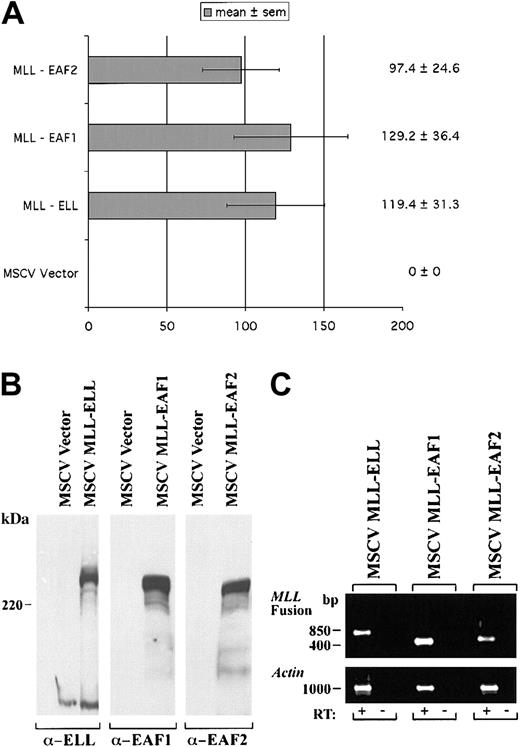 Fig. 10. A heterologous MLL-EAF2 fusion immortalizes hematopoietic cells. / The open reading frame of EAF2 was fused to the amino-terminus of MLL in the MSCV vector. High titer retroviruses were generated in Bosc23 cells and used to infect primary murine hematopoietic progenitor cells. For comparison, MLL-ELL, MLL-EAF1, and MSCV vector alone retroviral constructs were also examined. (A) The number of colonies generated in tertiary passage in methylcellulose cultures. (B) Expression of the MLL fusion proteins by Western blot in transiently transfected Bosc23 cells using antibodies to ELL, EAF1, and EAF2. (C) Expression of these constructs by RT-PCR in the transduced hematopoietic cells. Amplification from reverse transcribed cDNA is indicated by a plus symbol (+). To exclude contamination with integrated retroviral genomic DNA, a no reverse transcriptase control is indicated by a minus symbol (−).