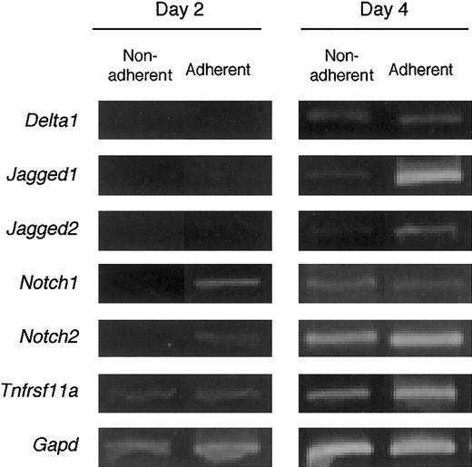 Fig. 5. BM cells cultured with M-CSF express genes for components of Notch signaling and RANK. / Freshly prepared BM cells were cultured with M-CSF (50 ng/mL). On days 2 and 4 of culture, dish-adherent and -nonadherent cells were harvested and the gene expression for Notch receptors and their ligands, and RANK (Tnfrsf11a) was examined by RT-PCR analyses. The expression of these genes was enhanced by culturing with M-CSF.