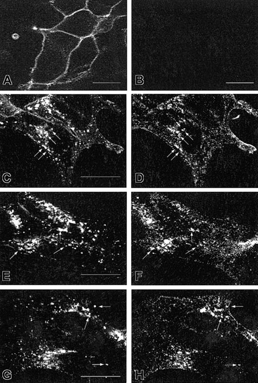 Fig. 4. Specific staining of CXCR2 and colocalization of CXCR2 with endogenous Rab5, Rab11a, and Rab7 in HEK293 cells. / For the specific staining of CXCR2, cells stably expressing (A) or not expressing (B) CXCR2 were fixed in methanol. Cells were incubated with a monoclonal CXCR2 antibody for 30 minutes, followed by incubation with an FITC-conjugated antimouse antibody for 30 minutes. Specific cell surface expression of CXCR2 was determined by confocal microscopy. For the colocalization of CXCR2 with the endogenous Rab proteins, cells stably expressing CXCR2 were treated with CXCL8 (200 nM) for 1 hour (C-F) or 4 hours (G-H), then fixed in methanol. Cells were incubated with a mixture of a monoclonal CXCR2 antibody and a rabbit antibody for Rab5 (C-D), Rab11a (E-F), or Rab7 (G-H), for 30 minutes. After washing with PBS, cells were incubated with a mixture of an FITC-conjugated antimouse antibody and a rhodamine-conjugated antirabbit antibody for 30 minutes. Representative confocal micrographs from 3 independent experiments demonstrating the intracellular localization of CXCR2 (C,E,G), Rab5 (D), Rab11a (F), and Rab7 (H) are shown. Arrows indicate the colocalization of CXCR2 with the individual Rab proteins. Bars, 10 μm.