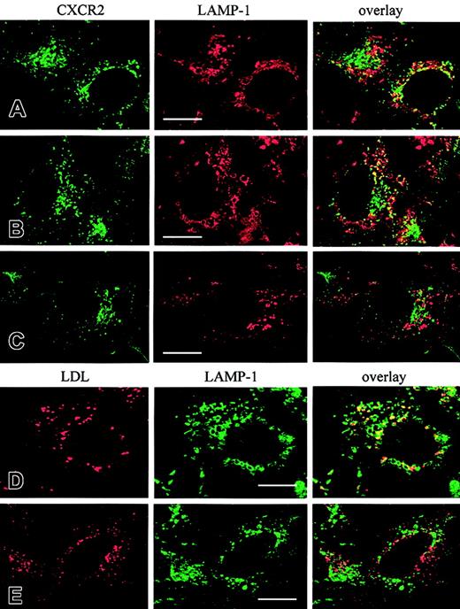 Fig. 10. Colocalization of CXCR2 or LDL with Lamp-1 in HEK293 cells overexpressing Rab7 or Rab7-T22N. / (A-C) Colocalization of CXCR2 with LAMP-1. HEK293 cells stably cotransfected with plasmids encoding CXCR2 and vector (A), CXCR2 and Rab7 (B), or CXCR2 and Rab7-T22N (C) were treated with CXCL8 at 37°C for 4 hours. Cells were fixed with methanol and incubated with a mixture of a rabbit CXCR2 antibody and a mouse monoclonal Lamp-1 antibody for 30 minutes, followed by a mixture of an FITC-conjugated antirabbit antibody and a rhodamine-conjugated antimouse antibody for 30 minutes. Representative laser-scanning confocal micrographs from independent experiments demonstrating the distribution of CXCR2 (green) and Lamp-1 (red) and the colocalization of CXCR2 with Lamp-1 (yellow) are shown. (D-E) Colocalization of LDL with LAMP-1. HEK293 cells stably expressing Rab7 (D) or Rab7-T22N (E) were incubated with Dil-LDL (40 μg/mL) at 37°C for 4 hours, then fixed in methanol. Cells were incubated with a monoclonal LAMP-1 antibody followed by incubation with an FITC-conjugated antimouse antibody. Representative confocal micrographs from 3 independent experiments demonstrating the distribution of LDL (red), Lamp-1 (green), and the colocalization of LDL with Lamp-1 (yellow) are shown. Images were processed using Photoshop software. Bars, 10 μm.