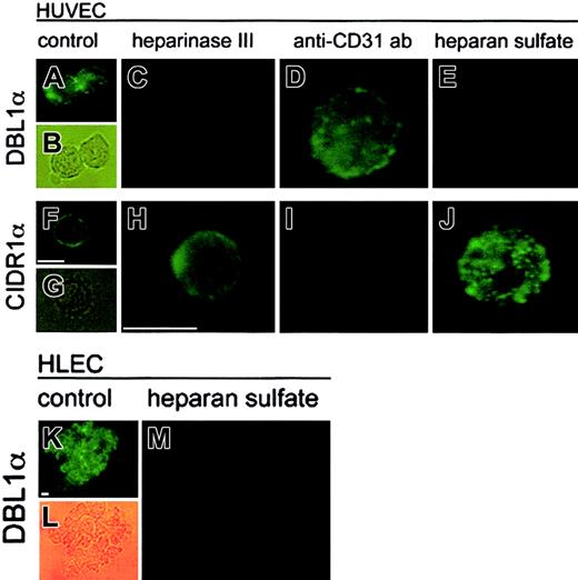 Fig. 3. Interaction of 2 individual domains of PfEMP1 expressed as recombinant GST-fusion proteins to human endothelial cells. / Binding of DBL1α (panels A-E,K-M) and CIDR1α (panels F-J) to nontreated HUVECs (panels A-B,F-G) or HLECs (panels K-L); heparinase III–treated HUVECs (0.2 IU/mL for 2 hours) (panels C,H); PECAM-1/CD31–blocked HUVECs (10 μg/mL anti–PECAM-1/CD31 antibody) (panels D,I); and soluble HS–treated (1 mg/mL) HUVECs (panels E,J) and HLECs (panel M). Binding was visualized by incubating the cells with a mouse anti-GST antibody following incubation with an FITC-conjugated antimouse antibody and analyzed by light microscopy (× 1000). Scale bar equals 15 μm.