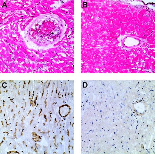 Fig. 2. Histology of WT hearts transplanted into PKM-immunized control mice and into tolerized mice. / Histology of WT hearts transplanted into PKM-immunized control mice, which were rejected after 30 minutes (A,C), or into tolerized mice and then removed 2 months after transplantation (B,D). Immunostaining of transplanted WT hearts with anti-IgM antibodies (C-D). (A) Hematoxylin-eosin (H&E) staining of WT heart undergoing hyperacute rejection in a PKM-immunized control mouse. Note the blood clot within the artery and the edema among the myocytes. (B) H&E staining of WT heart in a tolerized mouse. The tissue displays no abnormal features. The small spaces within and between the myocytes are an artifact of the staining procedure. (C) Immunostaining with anti-IgM antibodies, demonstrating IgM deposits (counterstaining with hematoxylin) in the WT heart undergoing rejection as in panel A. Similar deposits were observed in sections stained with antibodies to IgG, C3, and C5, using the corresponding antibodies. (D) Immunostaining for IgM deposits in WT heart transplanted into a tolerized mouse as in panel B. Note that no deposits of IgM are observed. Similarly, no distinct deposits of IgG, C3, or C5 were detected (not shown). Sections are from a representative mouse, out of 3 in each group. Original magnification, × 200.