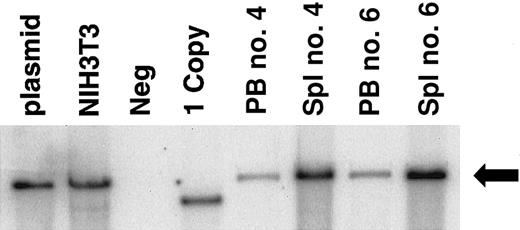 Fig. 2. Unrearranged d432β-Αγ 3′RE vector is present in the genomic DNA from PB leukocytes and spleen cells of animals 32 weeks following transplantation with vector-transduced BM cells. / Southern blot analysis, using a 32-P labeled RRE probe, of the indicated genomic DNA digested with BglII. This enzyme cuts once in the 5′ LTR and immediately inside the 3′ LTR of the integrated d432β-Aγ 3′RE vector (Figure 1A), thereby liberating a near unit length proviral form. DNA samples are as follows: (plasmid) d432β-Aγ 3′RE vector plasmid DNA mixed with genomic NIH3T3 DNA; (NIH3T3) NIH3T3 cells transduced with the d432β-Aγ 3′RE vector; (Neg) naive NIH 3T3 cells; (1 copy) MEL cells harboring a single copy of d432β-Aγ MSCV GFP (BglII digestion liberates a subgenomic vector fragment); PB, and (Spl) spleen of the indicated mice. Genomic DNA (15 μg) was used in all cases except for the PB lanes, which contained 5 μg. The arrow indicates a 7.2-kb hybridizing fragment, which is of the correct predicted size of an integrated, unrearranged d432β-Aγ 3′RE provirus.