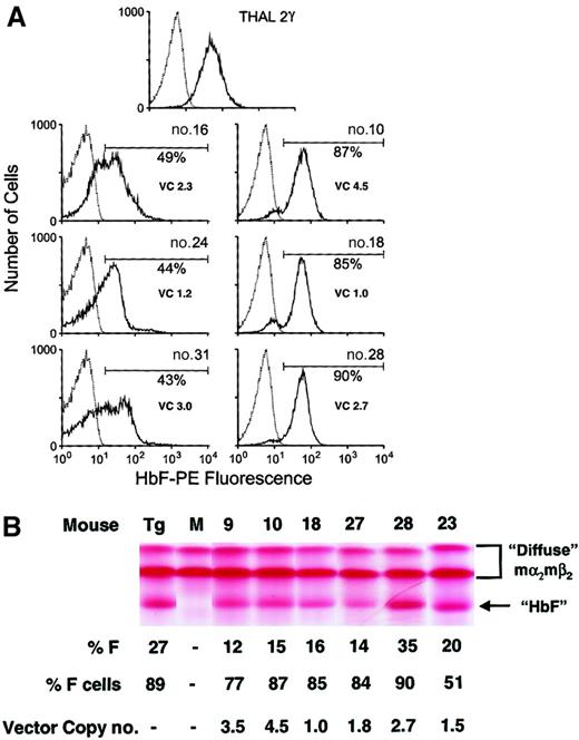 Fig. 4. Lentiviral vector-mediated human Aγ-globin expression in erythrocytes derived from transplanted, β-thalassemic repopulating cells transduced with the d432-β-Aγ lentiviral vectors. / (A) FACS analysis for human Aγ-globin expression (HbF-PE fluorescence) in β-thalassemic red cells 15 weeks following transplantation with γ-globin vector-transduced β-thalassemic BM cells. At top is the histogram from the β-thalassemic/γ-globin transgenic control animal. Below are histograms of γ-globin expression from representative mice (mouse numbers indicated) that received transplants of genetically modified cells (solid lines). The percentage of red cells with unequivocal γ-globin expression is shown at the right of each histogram along with the average PBL vector copy (VC) number. The dotted line indicates the staining profile of red cells from a mouse that received transplants of mock-transduced β-thalassemic BM cells. (B) Cellulose acetate Hb electrophoresis gels were used to separate the different Hb species of red cell lysates as indicated by the arrow to the right. This β-thalassemic mouse strain has the “diffuse” Hb pattern characterized by an uppermost mα2mβ2minor species and a faster migrating mα2β2maj species. Chimeric mα2hγ2 molecules migrate faster than the endogenous murine Hb species as demonstrated in the β-thalassemic/γ-globin transgenic mouse lane (Tg). No endogenous murine “single” Hb molecules, which migrate between the “diffuse” and chimeric species, were observed, indicating full donor engraftment. M indicates mouse that received transplants of mock-transduced β-thalassemic BM cells; numbered lanes represent samples from representative mice that received transplants of γ-globin vector-transduced β-thalassemic BM cells. % F indicates the quantity of the chimeric mα2hγ2species, estimated by densitometry, as a proportion of all Hb species. % F cells indicates the proportion of red cells staining for human γ-globin by FACS analysis. Vector copy number is the average copy number in PBLs as estimated by DNA PCR. For reference, the uppermost mα2mβ2minor band makes up approximately 20% of total mouse Hb.