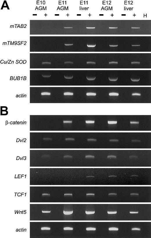 Fig. 1. Expression patterns of DD RT-PCR clones and Wnt signaling members. / (A) RT-PCR analysis was performed to verify the differential expression of several clones derived from the DD RT-PCR screening. RNA isolated from AGM and fetal liver at E10, E11, and E12 was used for cDNA synthesis and RT-PCR under standard conditions. For each primer set, optimal PCR conditions and annealing temperature were determined and PCR was performed for 30 to 40 cycles. Three of the genes,mTAB2, mTM9SF2, and β-catenin (Figure 1B) are up-regulated between E10 and E11 in the AGM. The other genes(BUB1B and Cu/Zn SOD), not showing a differential expression pattern, represent false-positive DD RT-PCR clones. (B) RT-PCR analysis was performed for several components of the Wnt signaling pathway. Several components of the Wnt signaling pathway can be detected in the AGM and fetal liver between E10 and E12. Besides the differential expression of β-catenin between E10 and E11 in the AGM, we could also detect up-regulation of Dvl3and Wnt5 in the AGM between E10 and E11. + and − indicate with and without reverse transcriptase, respectively; H, H2O.