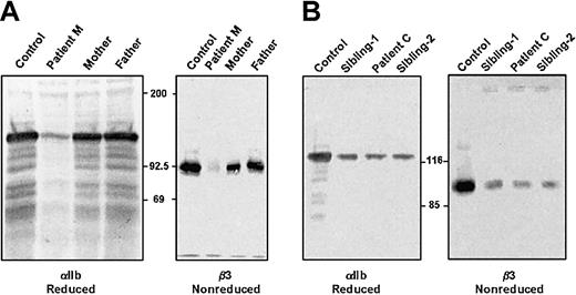Fig. 1. Immunoblots of platelet αIIb and β3 for patients M and C. / Platelets were solubilized in SDS, electrophoresed into a 7% polyacrylamide gel under reduced (αIIb) and nonreduced (β3) conditions, and electrotransferred to PVDF membranes. Equal amounts of protein were electrophoresed as judged by the staining of the gel after electrophoresis for platelet myosin heavy chain (Mr about 200 000). Membranes analyzed for αIIb were incubated with the mAb PMI-1, and membranes analyzed for β3 were incubated with the mAb 7H2.28 (A) Samples from patient M and his mother and father. (B) Samples from patient C and his 2 siblings.