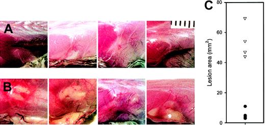 Fig. 2. Purified. / M luteus peptidoglycan produces larger and more inflamed lesions in lys M−/− mice. Each panel is a photograph of a lesion in an individual mouse on day 2. (A) F2 controls; (B) lys M−/− mice. (C) Areas of lesions in lys M−/− mice (▿) compared with F2 controls (●). Note that lesion areas are significantly larger in lys M−/− mice than in F2 controls (P < .001).