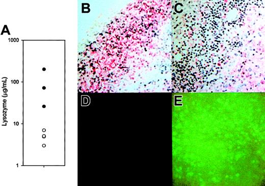 Fig. 3. Lysozyme activity and distribution in lesions. / (A) Lysozyme concentration 48 hours after M luteus injection in tissues of lys M−/− mice (○; n = 4) compared with F2 control mice (●; n = 3). The difference between the geometric means, 4.79 μg/mL vs 72.4 μg/mL, is significant atP = .004 (t test, after logarithmic transformation). (B-C) Sections of lesions from an F2 control and lys M−/− mouse, respectively, immunostained with antibody reactive with lysozymes M and P (red stain, blue hematoxylin nuclear counterstain). Note that most inflammatory cells in the lesions of F2 mice are reactive with antilysozyme antibody, but in lys M−/− lesions inflammatory cells with polymorphonuclear morphology (neutrophils) are not reactive. (D-E) Lesions of F2 mice show only background fluorescence, while those of lys M−/− mice express abundant EGFP from the knockout construct.