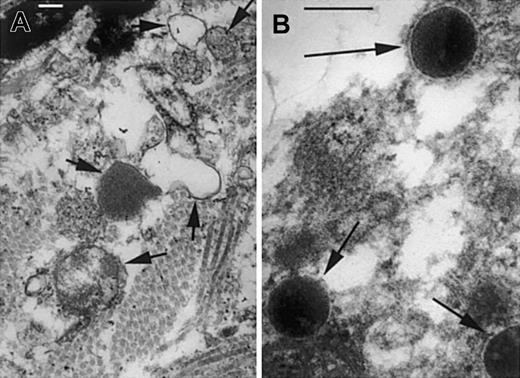 Fig. 6. Cell wall structure of. / M luteus is disrupted in lesions of F2 control mice but preserved in lys M−/− mice. At 7 hours after infection, the infected lesions of F2 controls (A) contain bacterial cell wall fragments and ghosts (short arrows), but lys M−/− mice (B) show bacteria with well-preserved cell walls and normal electron-dense cytoplasm (long arrows). Bars, 0.2 μm.