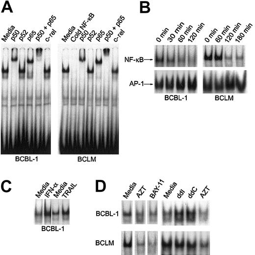 Fig. 3. AZT inhibits constitutive NF-κB nuclear activity in PEL. / (A) NF-κB complexes in primary PEL (BCLM) and BCBL-1 are composed of p50/p65 heterodimer. Purified nuclear extracts (15 μg) from PEL cells were preincubated with the indicated antibodies and subjected to EMSA using the 32P-labeled NF-κB oligonucleotide probe. The results are representative of 3 independent experiments. (B) AZT blocks NF-κB nuclear colocalization in PEL. Nuclear extracts were prepared from cells treated with AZT (10 μg/mL) for the indicated times, and binding activity was assayed by EMSA using either NF-κB (top panels) or AP-1 (bottom panels) specific consensus oligonucleotides as probes. (C) Induction of NF-κB by IFN-α and soluble TRAIL in BCBL-1. BCBL-1 cells were treated with either IFN-α (1000 U/mL) for 18 hours or soluble TRAIL (50 ng/mL) for 1 hour. Nuclear extracts were then assayed by EMSA for NF-κB. (D) Effect of nucleoside analogs and BAY-11 on NF-κB translocation. BCBL-1 and BCLM cells were treated with AZT (10 μg/mL), BAY-11 (10 μM), ddI (10 μg/mL), or ddC (10 μg/mL) for 2 hours and assayed by EMSA using NF-κB consensus oligonucleotides as probes.