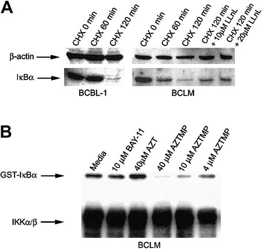 Fig. 5. AZTMP inhibits IKKβ-mediated phosphorylation of IκBα. / (A) PEL cells constitutively express IKK. BCBL-1 and BCLM cells were treated with CHX (50 μg/mL) for 1 and 2 hours, and Western blot analysis of whole-cell extracts was performed using antibodies specific for IκBα, with β-actin used as a control. BCLM cells were also treated with CHX for 2 hours in the presence of the proteosome inhibitor LLnL (10 and 20 μM) and assayed for IκBα by Western blot analysis. (B) Phosphorylated AZT (AZTMP) specifically inhibits IKK activity. Top panel: 100 μg cytosolic extract from BCLM cells was immunoprecipitated with anti-IKKα/β polyclonal antibody. The purified enzyme was incubated in vitro with medium, BAY-11 (10 μM), AZT (40 μM), or AZTMP (40, 10, and 4 μM). IKK activity was measured using recombinant GST-IκBα (1-317) as a substrate in the presence of 32P-ATP. Bottom panel: Western blot analysis using the same IKK antibody.